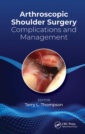 Thompson |  Arthroscopic Shoulder Surgery | Buch |  Sack Fachmedien