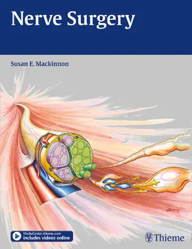 Mackinnon |  Nerve Surgery | eBook | Sack Fachmedien