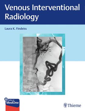 Findeiss |  Venous Interventional Radiology | eBook | Sack Fachmedien