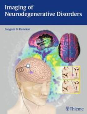 Kanekar |  Imaging of Neurodegenerative Disorders | eBook | Sack Fachmedien