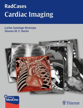 Restrepo / Bardo |  Radcases Cardiac Imaging | eBook | Sack Fachmedien