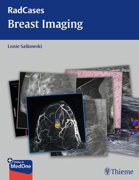 Salkowski |  Radcases Breast Imaging | eBook | Sack Fachmedien