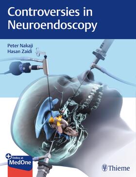 Nakaji / Zaidi | Controversies in Neuroendoscopy | E-Book | sack.de