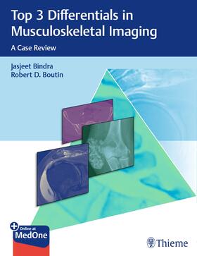 Bindra / Boutin |  Top 3 Differentials in Musculoskeletal Imaging | eBook | Sack Fachmedien