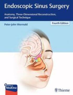 Wormald |  Endoscopic Sinus Surgery | eBook | Sack Fachmedien