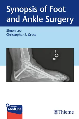 Lee / Gross |  Synopsis of Foot and Ankle Surgery | eBook | Sack Fachmedien