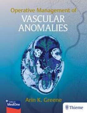 Greene |  Operative Management of Vascular Anomalies | eBook | Sack Fachmedien