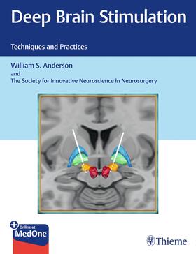 Anderson |  Deep Brain Stimulation | eBook | Sack Fachmedien