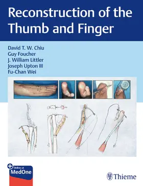 Chiu / Foucher / Littler |  Reconstruction of the Thumb and Finger | eBook | Sack Fachmedien