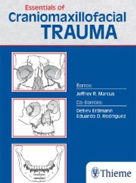 Marcus |  Essentials of Craniomaxillofacial Trauma | eBook | Sack Fachmedien