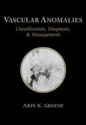 Greene |  Vascular Anomalies | eBook | Sack Fachmedien