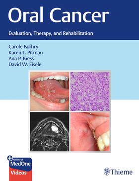 Fakhry / Pitman / Kiess |  Oral Cancer | eBook | Sack Fachmedien