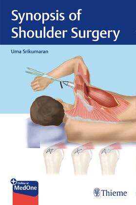 Srikumaran |  Synopsis of Shoulder Surgery | eBook | Sack Fachmedien