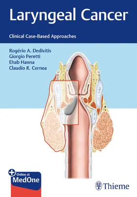 Peretti / Dedivitis / Hanna |  Laryngeal Cancer | Buch |  Sack Fachmedien