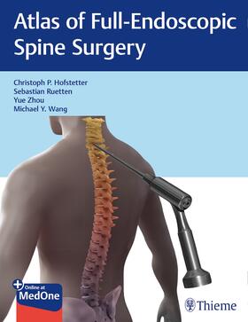 Hofstetter / Ruetten / Zhou |  Atlas of Full-Endoscopic Spine Surgery | Buch |  Sack Fachmedien