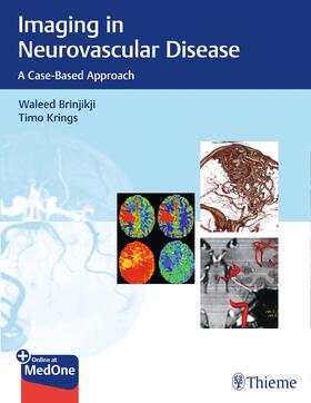 Brinjikji / Krings |  Imaging in Neurovascular Disease | Buch |  Sack Fachmedien