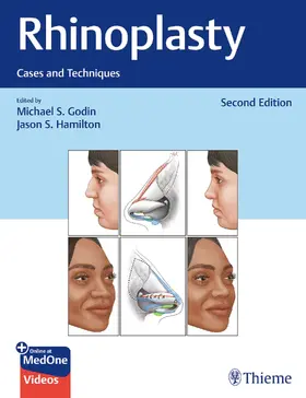 Godin / Hamilton |  Rhinoplasty | Buch |  Sack Fachmedien