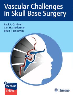 Gardner / Snyderman / Jankowitz |  Gardner, Vascular Challenges Skull Surgery | Buch |  Sack Fachmedien