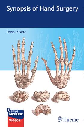 LaPorte |  Synopsis of Hand Surgery | eBook | Sack Fachmedien