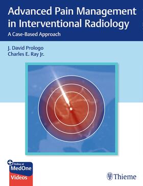 Prologo / Ray |  Advanced Pain Management in Interventional Radiology | Buch |  Sack Fachmedien
