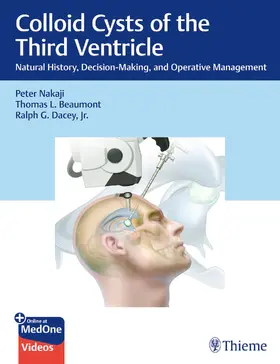 Nakaji / Beaumont / Dacey |  Colloid Cysts of the Third Ventricle | Buch |  Sack Fachmedien