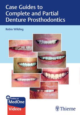 Wilding |  Case Guides to Complete and Partial Denture Prosthodontics | Buch |  Sack Fachmedien