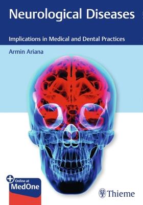 Ariana |  Neurological Diseases | Buch |  Sack Fachmedien