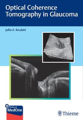 Rosdahl |  Rosdahl, J: Optical Coherence Tomography in Glaucoma | Buch |  Sack Fachmedien