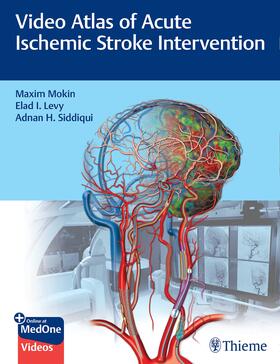 Mokin / Levy / Siddiqui |  Video Atlas of Acute Ischemic Stroke Intervention | Buch |  Sack Fachmedien