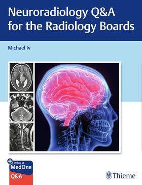 Iv |  Neuroradiology Q&A for the Radiology Boards | Buch |  Sack Fachmedien