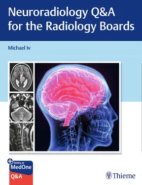 Iv |  Neuroradiology Q&A for the Radiology Boards | eBook | Sack Fachmedien