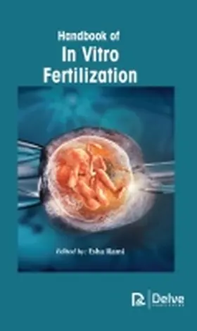 Rami |  Handbook of in Vitro Fertilization | Buch |  Sack Fachmedien