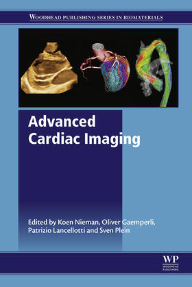 Nieman / Gaemperli / Lancellotti |  Advanced Cardiac Imaging | eBook | Sack Fachmedien