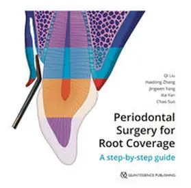 Liu / Zhang / Yang | Periodontal Surgery for Root Coverage | Buch | 978-1-78698-097-7 | sack.de