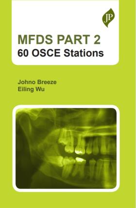 Wu / Breeze |  MFDS PART 2: 60 OSCE stations | Buch |  Sack Fachmedien