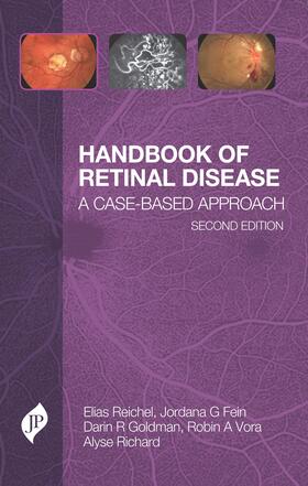 Reichel / Fein / Goldman |  Handbook of Retinal Disease | Buch |  Sack Fachmedien