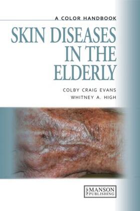 Evans / High |  Skin Diseases in the Elderly | Buch |  Sack Fachmedien