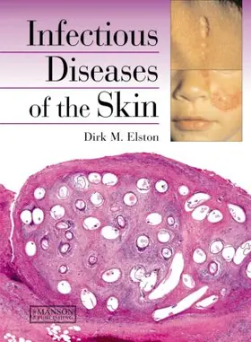 Elston |  Infectious Diseases of the Skin | Buch |  Sack Fachmedien