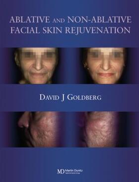 Goldberg |  Ablative and Non-ablative Facial Skin Rejuvenation | Buch |  Sack Fachmedien