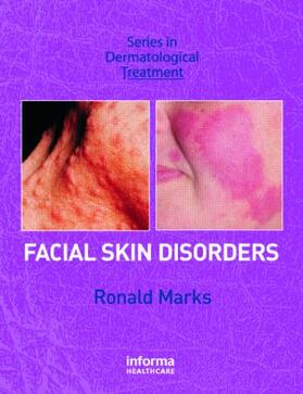 Marks |  Facial Skin Disorders | Buch |  Sack Fachmedien