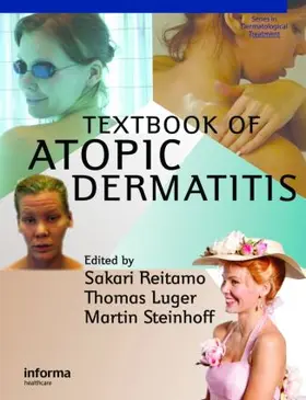 Reitamo / Luger / Steinhoff |  Textbook of Atopic Dermatitis | Buch |  Sack Fachmedien