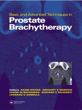 Dicker / Merrick / Gomella |  Basic and Advanced Techniques in Prostate Brachytherapy | Buch |  Sack Fachmedien