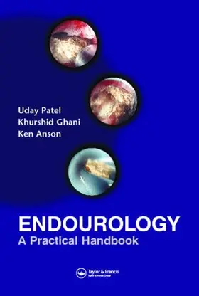 Patel / Anson / Ghani |  Endourology | Buch |  Sack Fachmedien