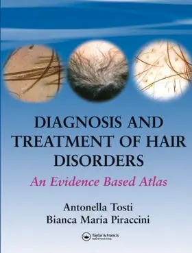 Tosti / Piraccini |  Diagnosis and Treatment of Hair Disorders | Buch |  Sack Fachmedien