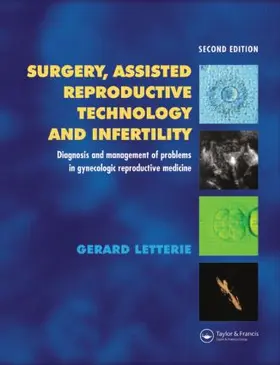 Letterie |  Surgery, Assisted Reproductive Technology and Infertility | Buch |  Sack Fachmedien