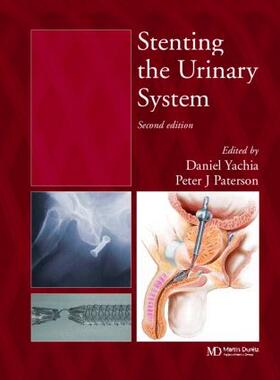 Yachia / Paterson |  Stenting the Urinary System | Buch |  Sack Fachmedien