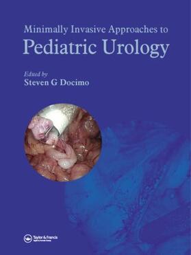Docimo |  Minimally Invasive Approaches to Pediatric Urology | Buch |  Sack Fachmedien