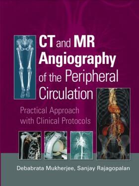 Mukherjee / Rajagopalan |  CT and MR Angiography of the Peripheral Circulation | Buch |  Sack Fachmedien
