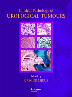 Mikuz |  Clinical Pathology of Urological Tumours | Buch |  Sack Fachmedien