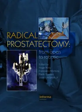 Kirby / Montorsi / Smith |  Radical Prostatectomy | Buch |  Sack Fachmedien